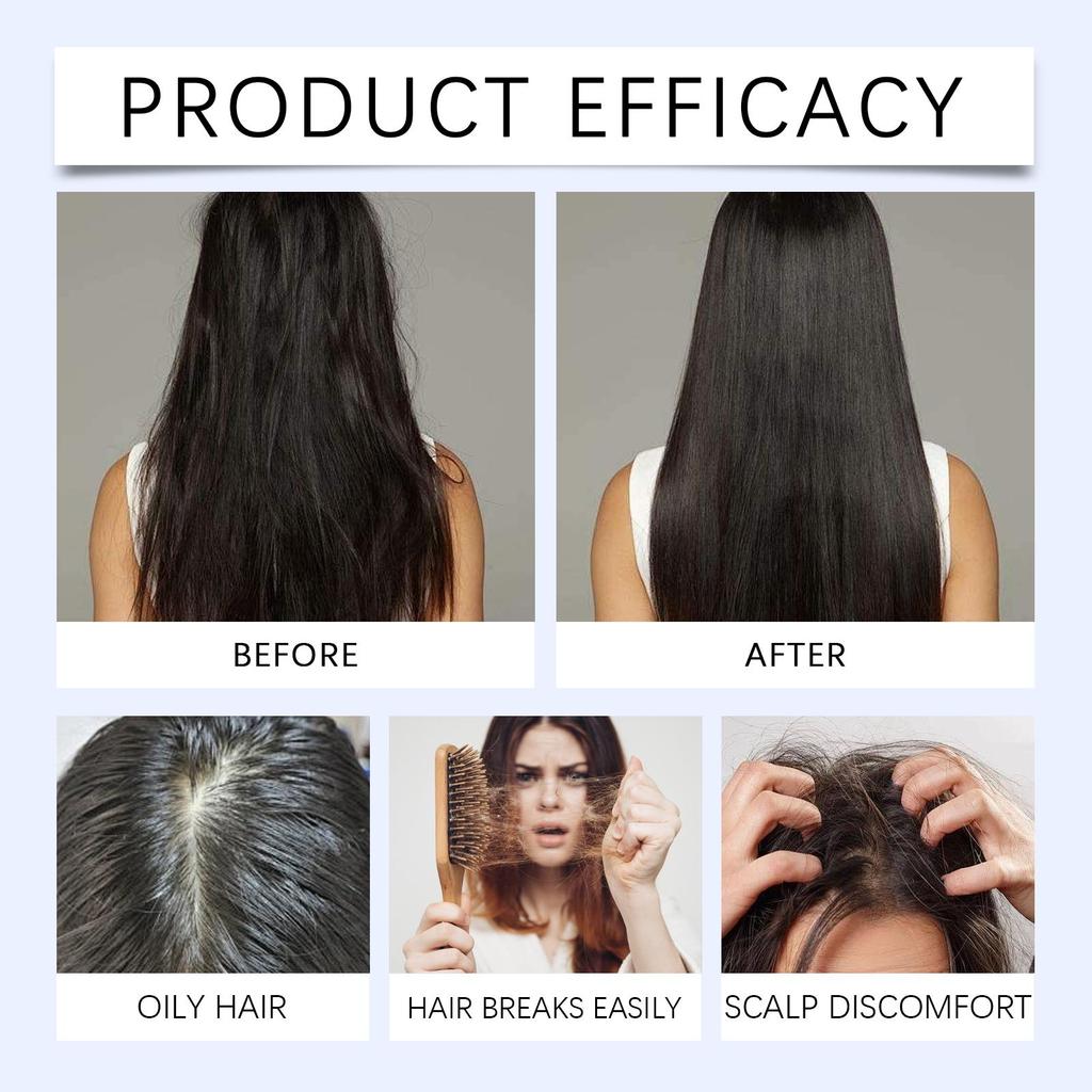 AMZ Rosemary Hair Growth Roll-On Serum – Moisturizing, Strengthening, Follicle Care for Healthy Hair, 30ml