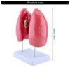 Human Anatomical Lung Model with Detachable Parts Normal Lung Anatomy Model for Clinical Settings and Lecture Report