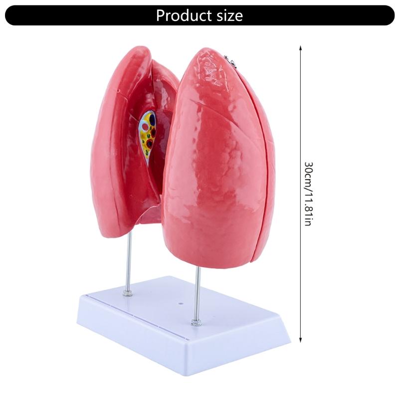 Human Anatomical Lung Model with Detachable Parts Normal Lung Anatomy Model for Clinical Settings and Lecture Report