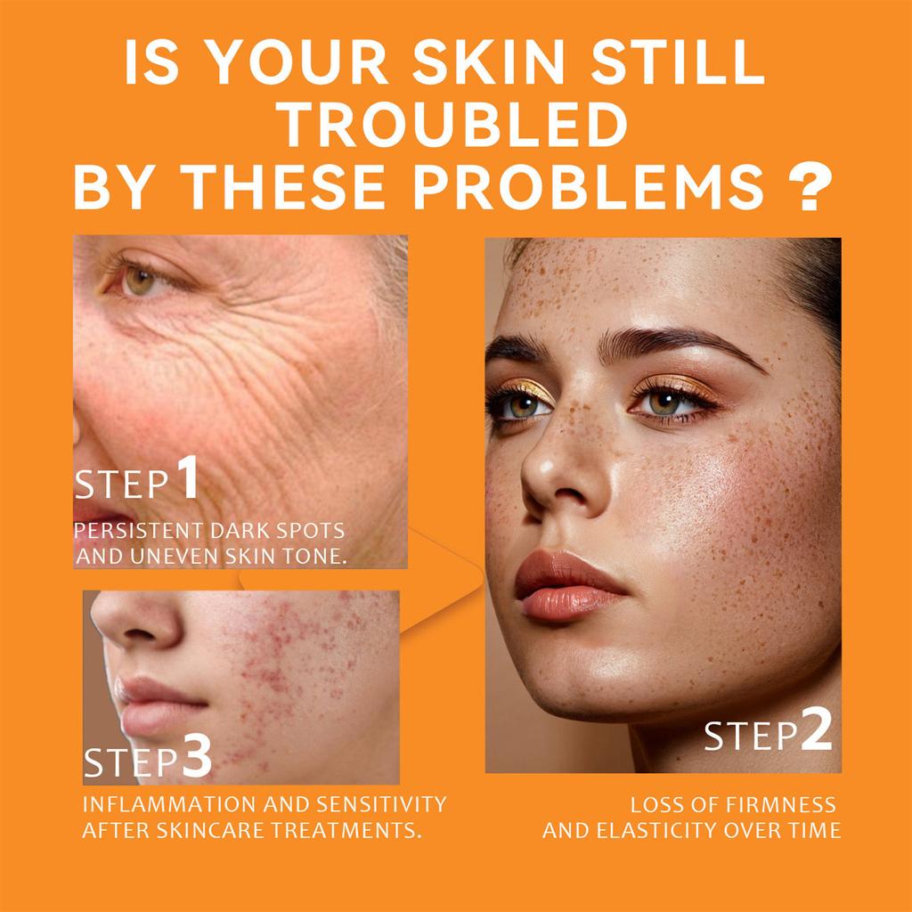 Acne Cream Skin Face Hydrating Moisturizing Acne Cream