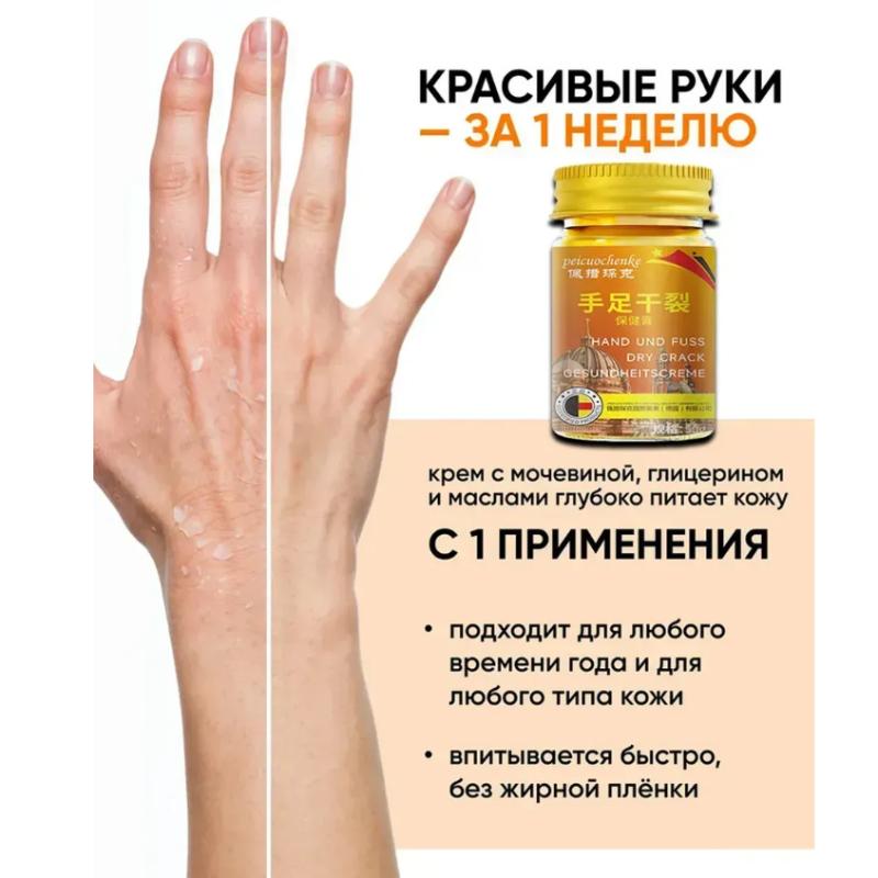 Medical Ointment for the Treatment of Cracks on Hands and Feet, 50g
