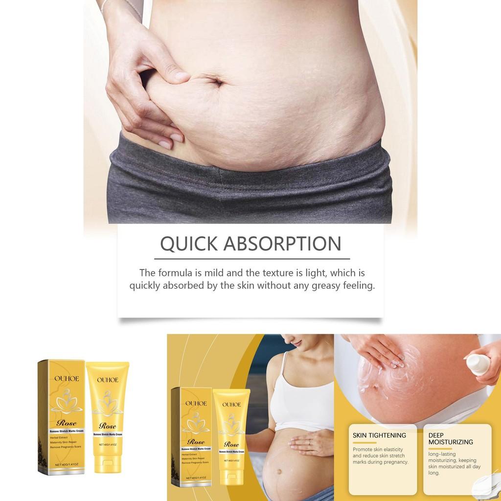 Ouhoe Pregnancy Care Rose Cream For Moisturizing And Firming Skin Reducing Stretch Marks