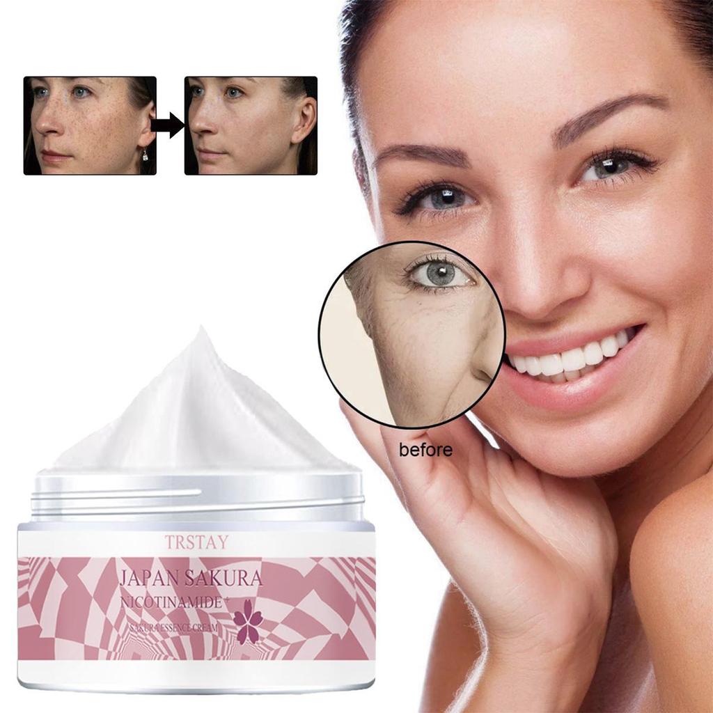 TRSTAY Moisturizing Cream, Vitamin C Brightening Face Cream, Brightening Skin And Lightening Spots