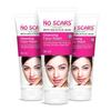 NO SCARS Aloevera Ansiktsvask For Dyprens | Klar Hud, Reduserer Kviser - Menn & Kvinner 60ml (Pakke med 3)