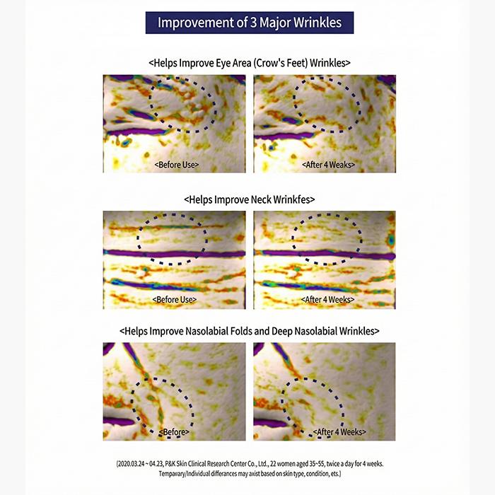 Dr.Pepti Peptide Volume Essence 2.0 Bubble-Type Peptide Foam Essence 100ml (3 Options)