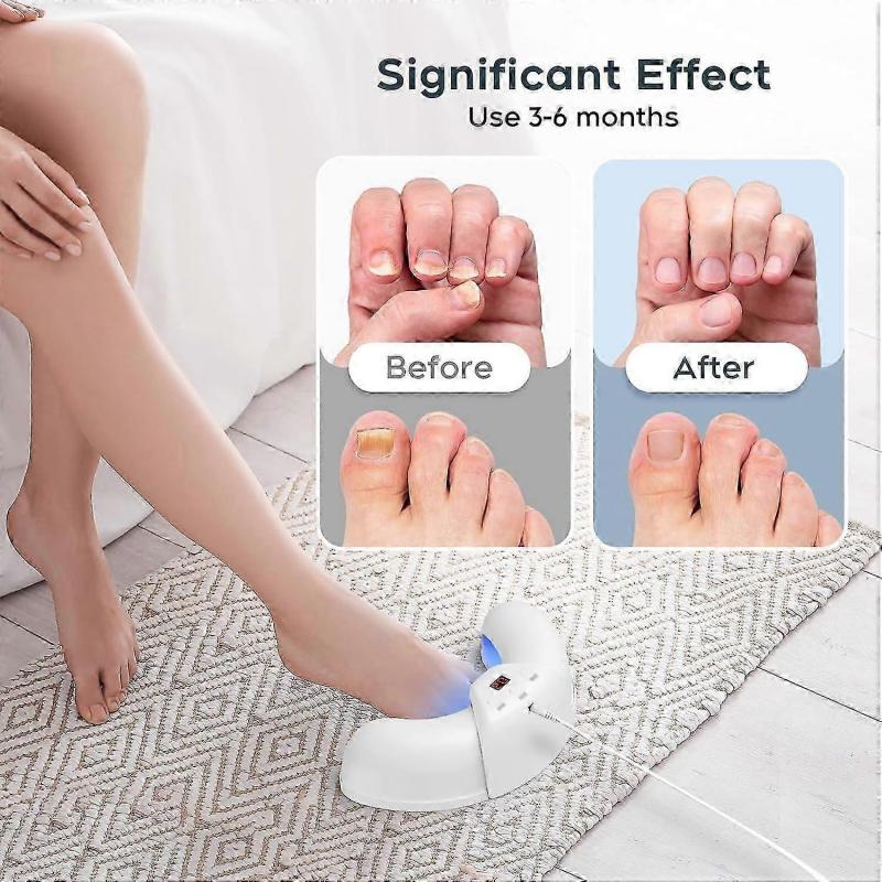 Nail Fungus Laser Treatment Device for Multiple Toenail, Home Use 905nm Infrared Light + 470nm Blue Light Toe Nail