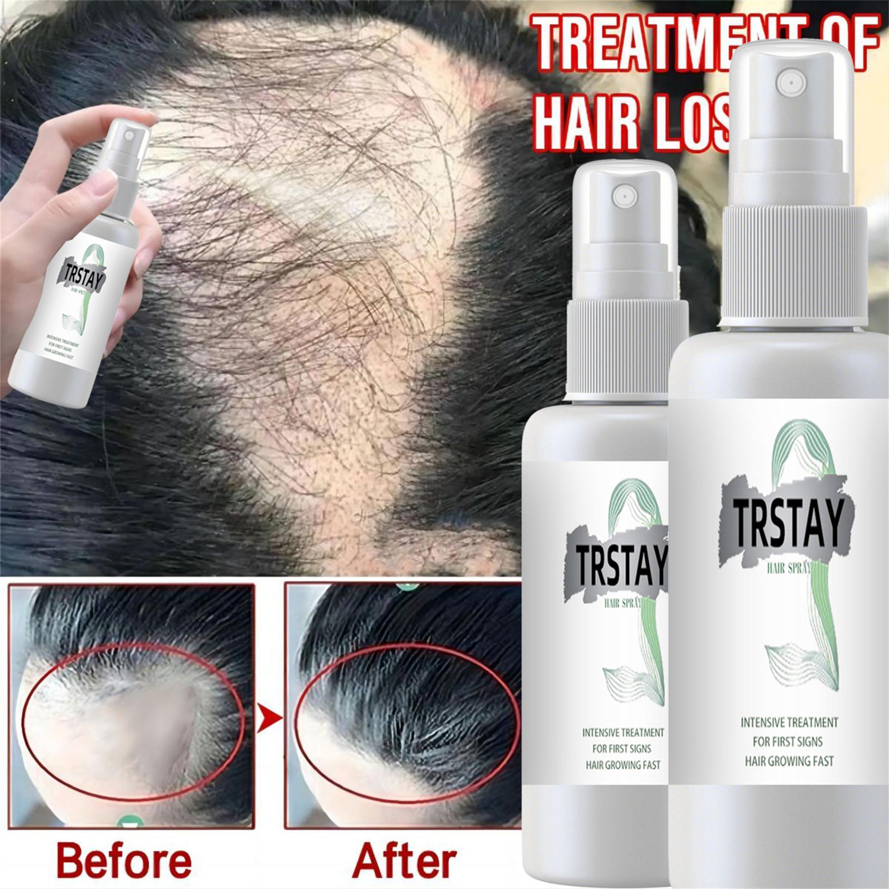 

Anti Alopecia Oil Fast Growth Hair Loss Care Product Male Hair Growth Essence Thickener