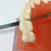 5 Stück oder 10 Stück Dental Metall Polierstab Polier-Schleifstreifen mit Verzahnung Ganzer Streifen Gezahnte Kante 4mm Zahnaufhellungsmaterialien