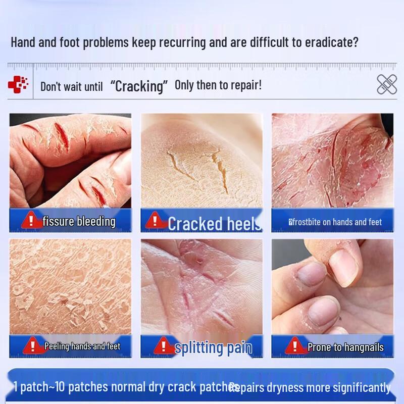 FIVERAMS Horse Oil Hand & Foot Anti-Crack Patches