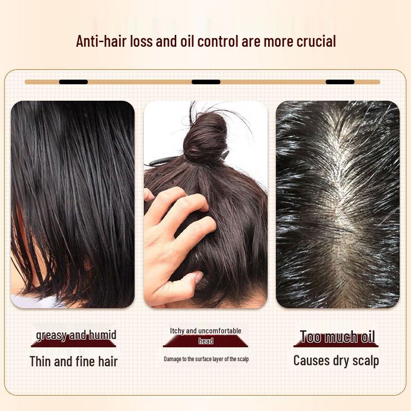 Bawang Anti-Hair Loss Shampoo