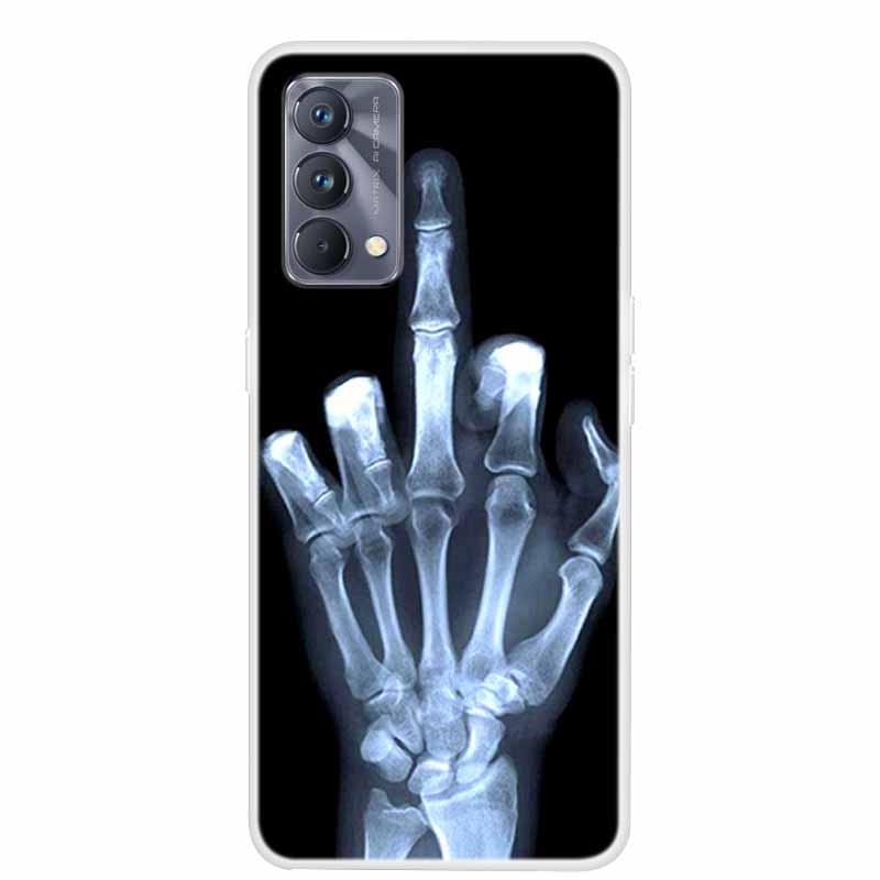 For Realme GT Master Edition Case Animal Soft Silicone TPU Phone Cover Case for Realme GT Explorer Master Edition Fruit Coque