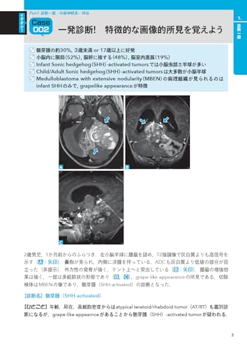 X-Ray! 10-Second Imaging Diagnostics: Practical Knowledge Learned from Influencers