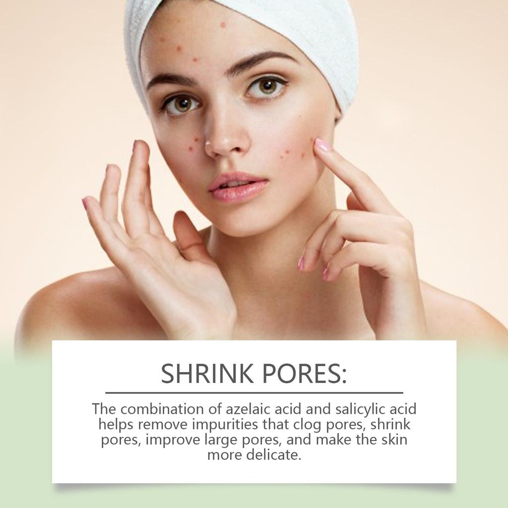 Azelaic Facial Serum Moisturizes And Improves The Skin For Blackheads And Acne 30ml