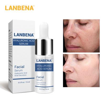 Hyaluronsäure-Serum, feuchtigkeitsspendende Essenz, behandelt Mitesser, Akne, zeitlose Wiederherstellung