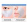 MediFlower - ARONYX Hyaluronic Acid Collagen Eye Patch