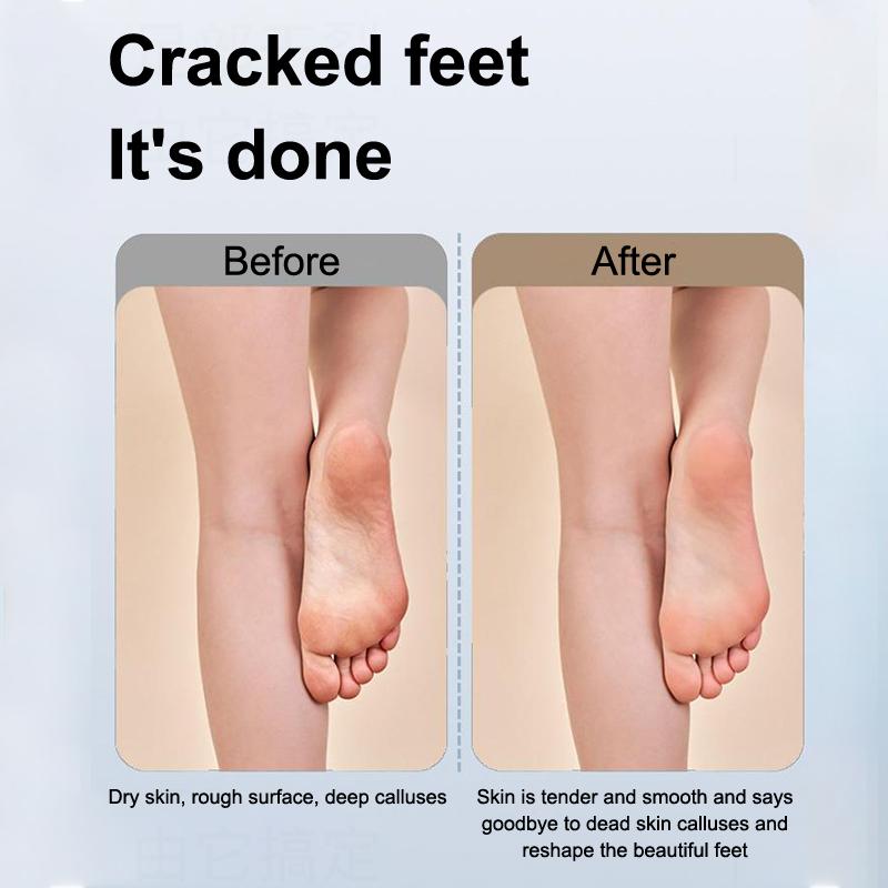 Raschietto Elettrico per Piedi Automatico Senza Fili Rimuove Pelle Morta Calli Screpolature Pelle Dura Screpolata Strumento per Pedicure Pulitore per Piedi Impermeabile