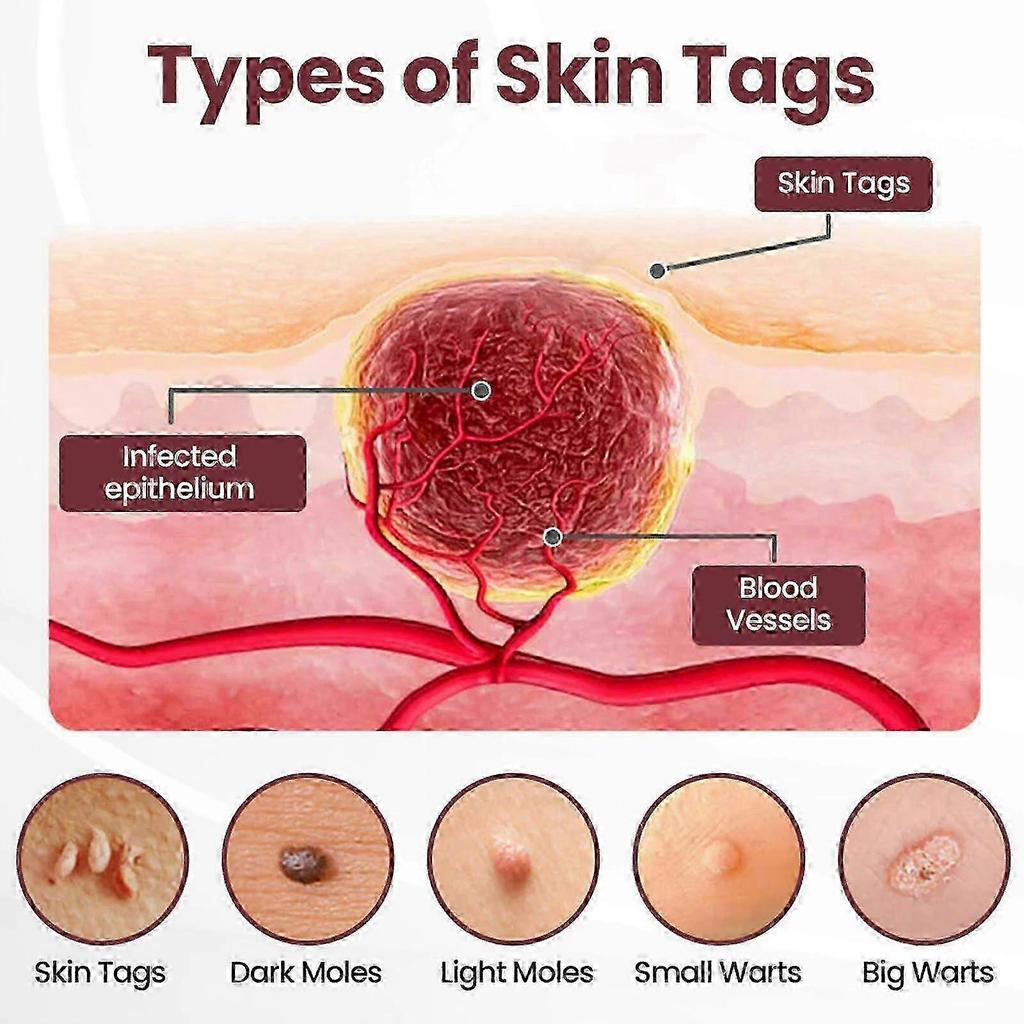 Skin Tags Removal Cream, Black Rice Exfoliating Treatment for Women & Men, Dual - Action Exfoliation & Brightening