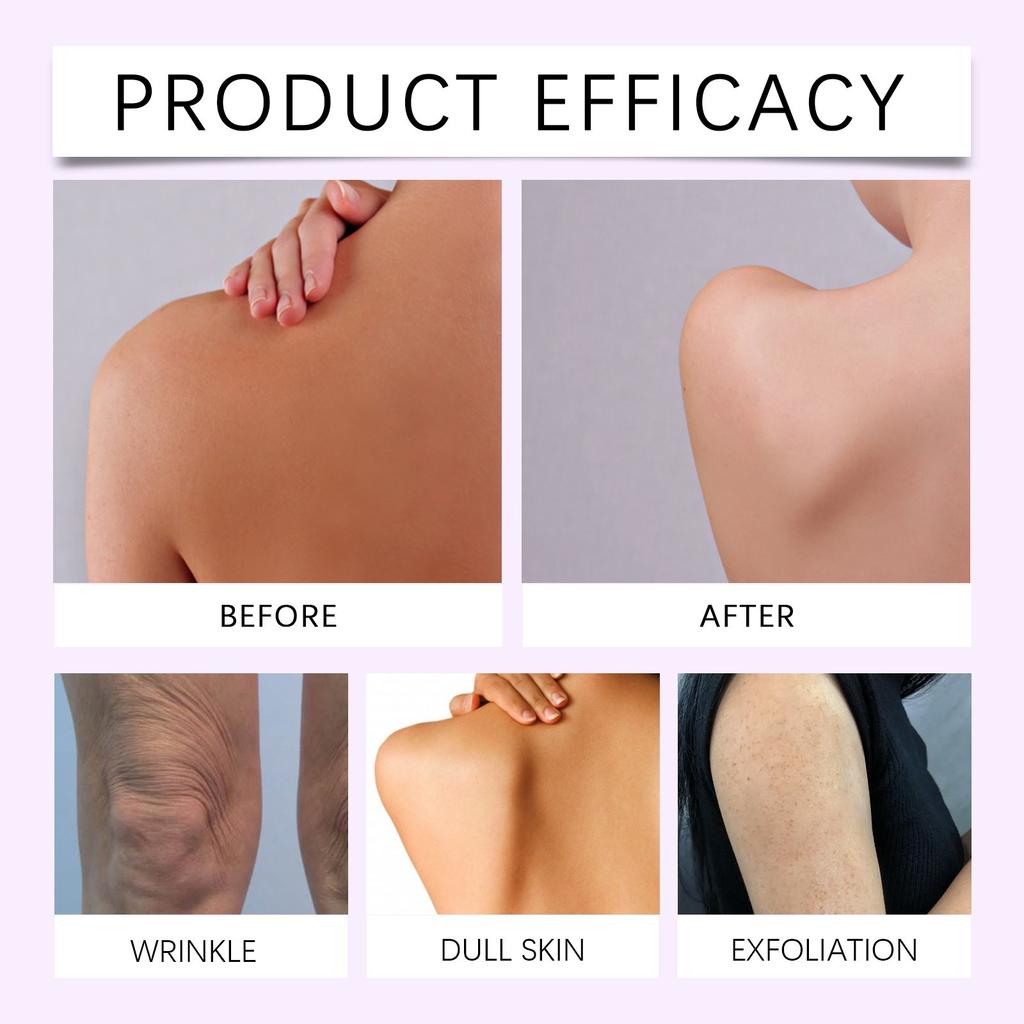 Hydratační krém s Puerarií Hydratuje, Zpevňuje, Hydratuje a Zvyšuje Elasticitu Pokožky Tělový Krém