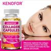 Hydrolysiertes Rinderkollagen Kapseln mit Biotin & Vitamin C, GVO-freies Nahrungsergänzungsmittel, 120 Kapseln 60-Tage-Vorrat