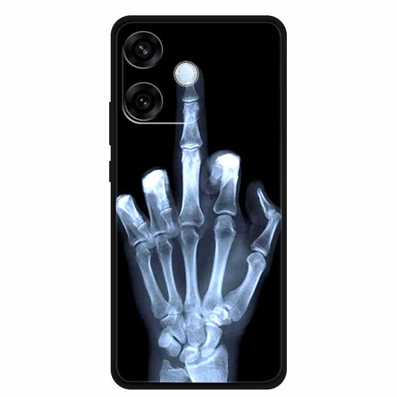 For Oppo A5 Pro 4G 5G Case 6.67" Soft TPU Silicone Funda Cut Cat Flower Painted Back Cover for Oppo A5 Pro 5G Global Shell Coque