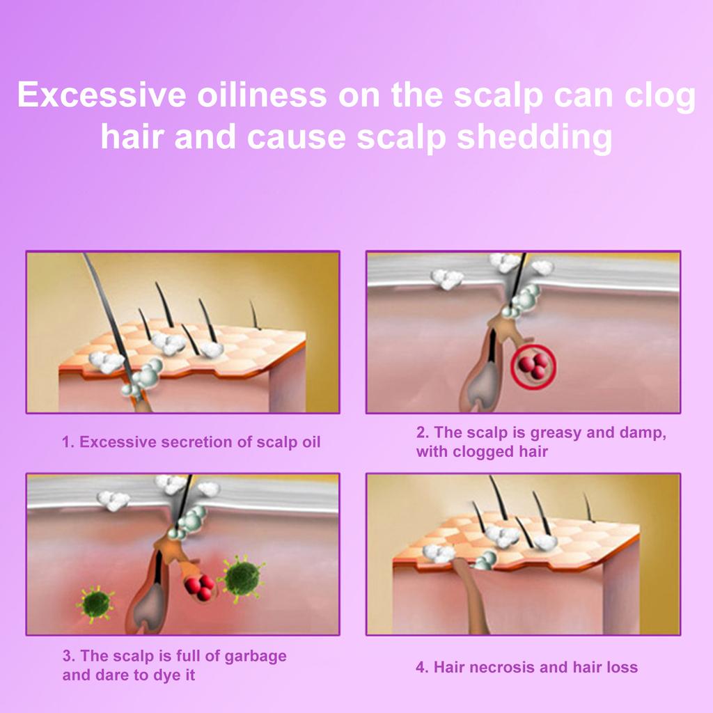 Lasers Hair Growth Cap, Red Light Therapys For Hair Regrowth, Lasers Therapys Cap For Hair Loss, Hair Loss Hat For Men & Women