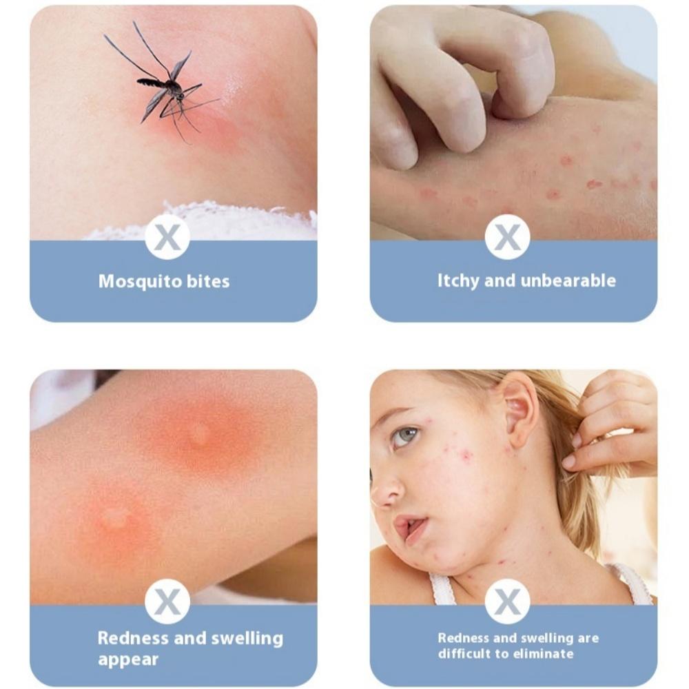Portable Mosquito Insect Bite Relieve Itching Pen Natural Mosquito Bite Heat Pen Chemical-Free Anti-Itch Pen for Adult Children