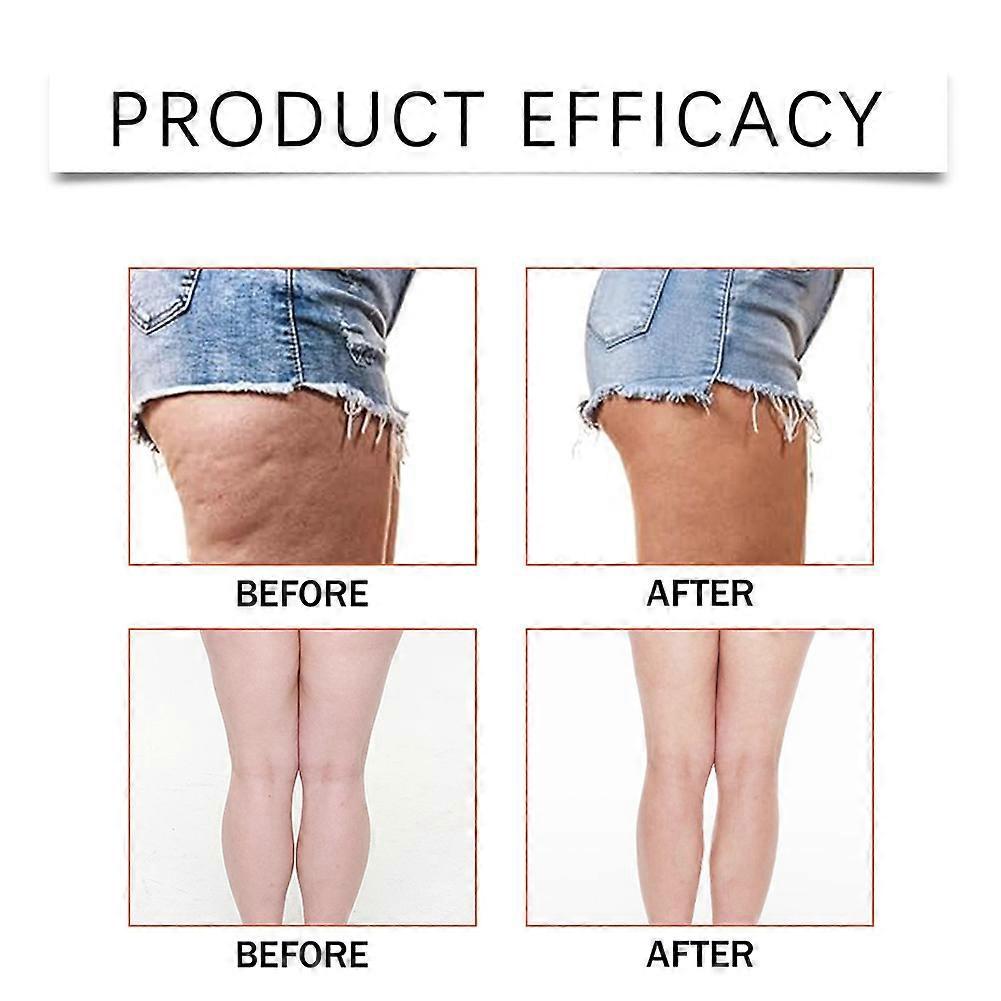 Thigh Lift Tape for Creepy Skin, Lift & Glow Patches for Cellulite Reduction, Invisible Sweatproof Sticker for Short Skirts