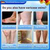Ointment for Treating Varicose Veins