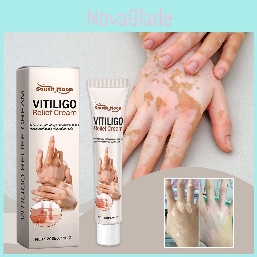 South Moon Skin Care Cream Relieves Itchy Hands And Feet Moisturizing Body Lotion