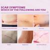 Ouhoe Scar Care Cream For Smoothing And Moisturizing Skin With Gentle Formula