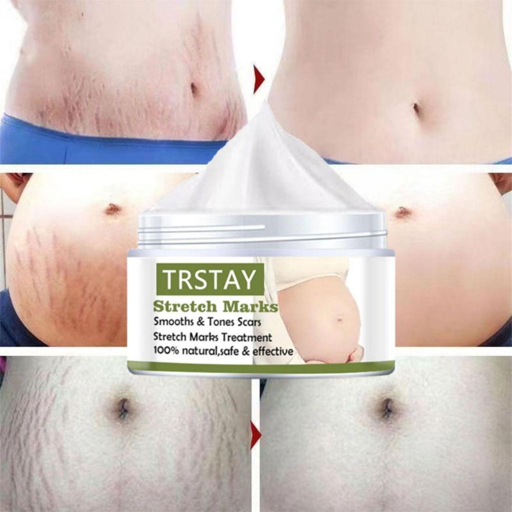 Krem na rozstępy Kobiety w ciąży po porodzie rozstępy krem na bielenie skóry krem wybielający