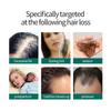 Ginger King Anti-Hair Loss & Hair Growth Spray 30ml
