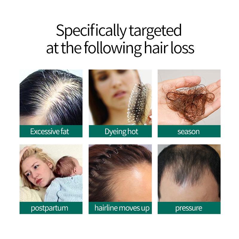 Ginger King Anti-Hair Loss & Hair Growth Spray 30ml