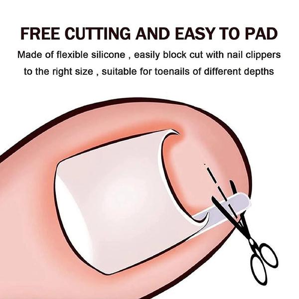 10pcs / Box Ingrown Nail Pad Nail Filling Nail Groove Pad Ingrown Nail Corrector Ingrown Nail Artifact Foot Care Tools