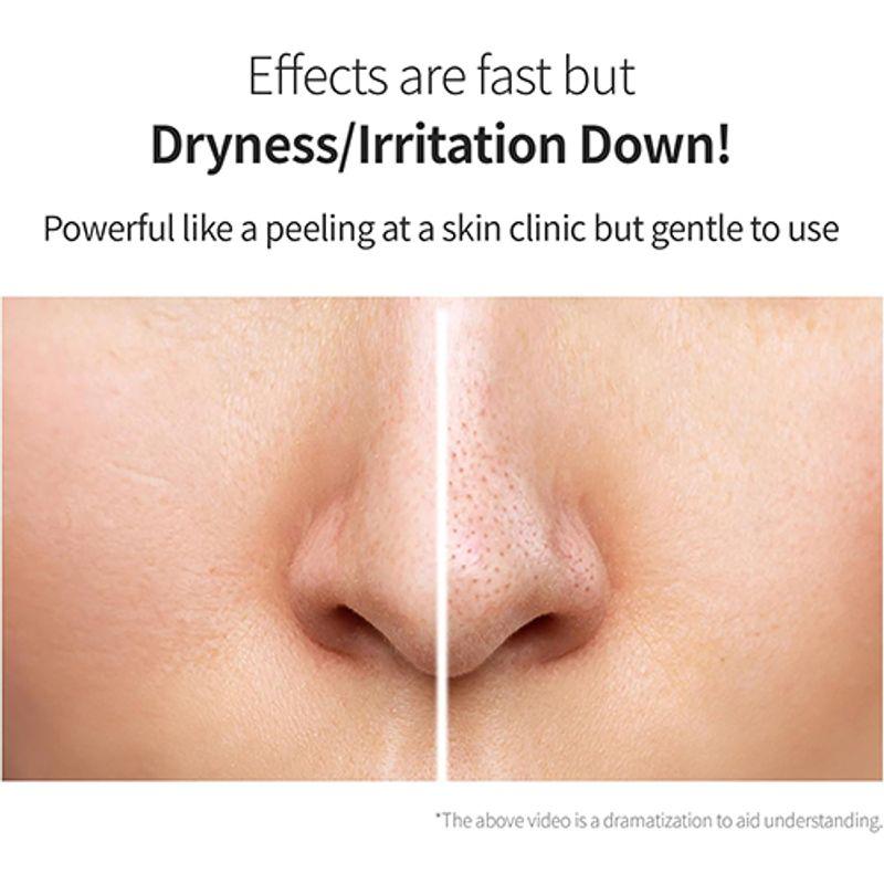 Benton Glykolsäure 7 % Peeling-Toner 150 ml