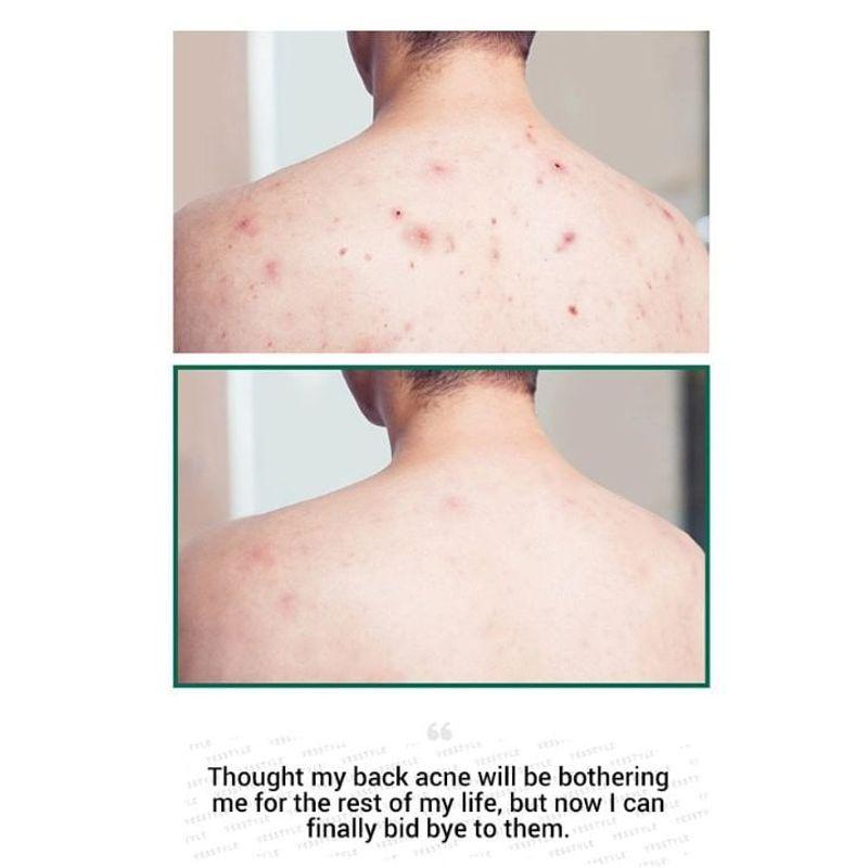 SOME BY MI AHA, BHA, PHA 30 Days Miracle Cleansing Bar 1pc