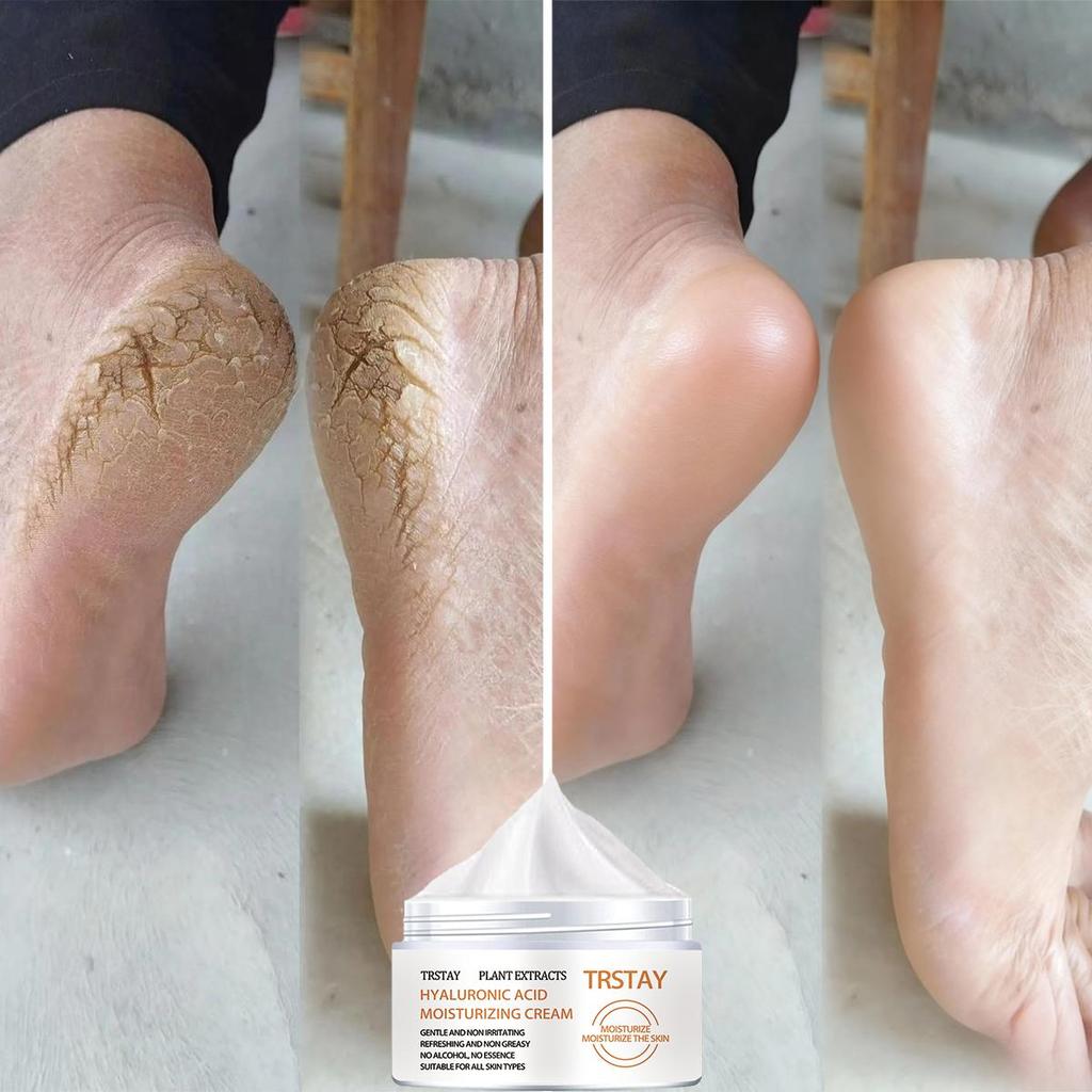 5G/15G/30G/50G/TRSTAY Foot Cream Cares for Foot Skin