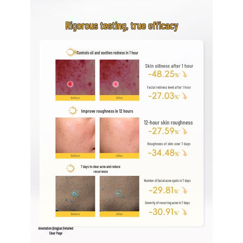 Kangaroo Mommy Acne Control Clarifying Toner