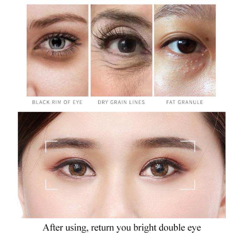 Oční krém proti stárnutí proti vráskám Odstraňuje tmavé kruhy pod očima Hydratační zpevňující oční péče