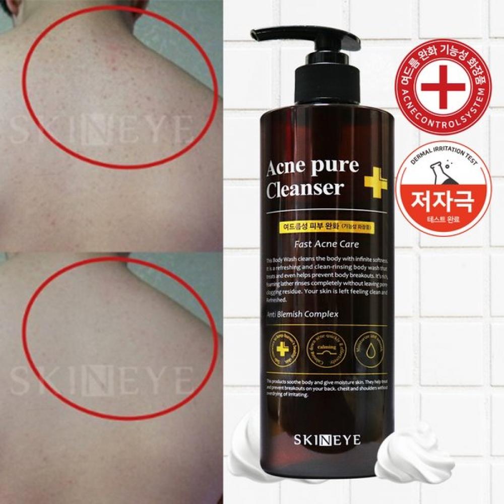 Acne Pure Cleanser   Functional Body Cleanser For Acne Prone Skin