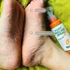 100ML Foot Peeling Spray Nourish Moisturizing Elbow Exfoliating Essence Dead Skin Remover Pedicure Foot Care Tool