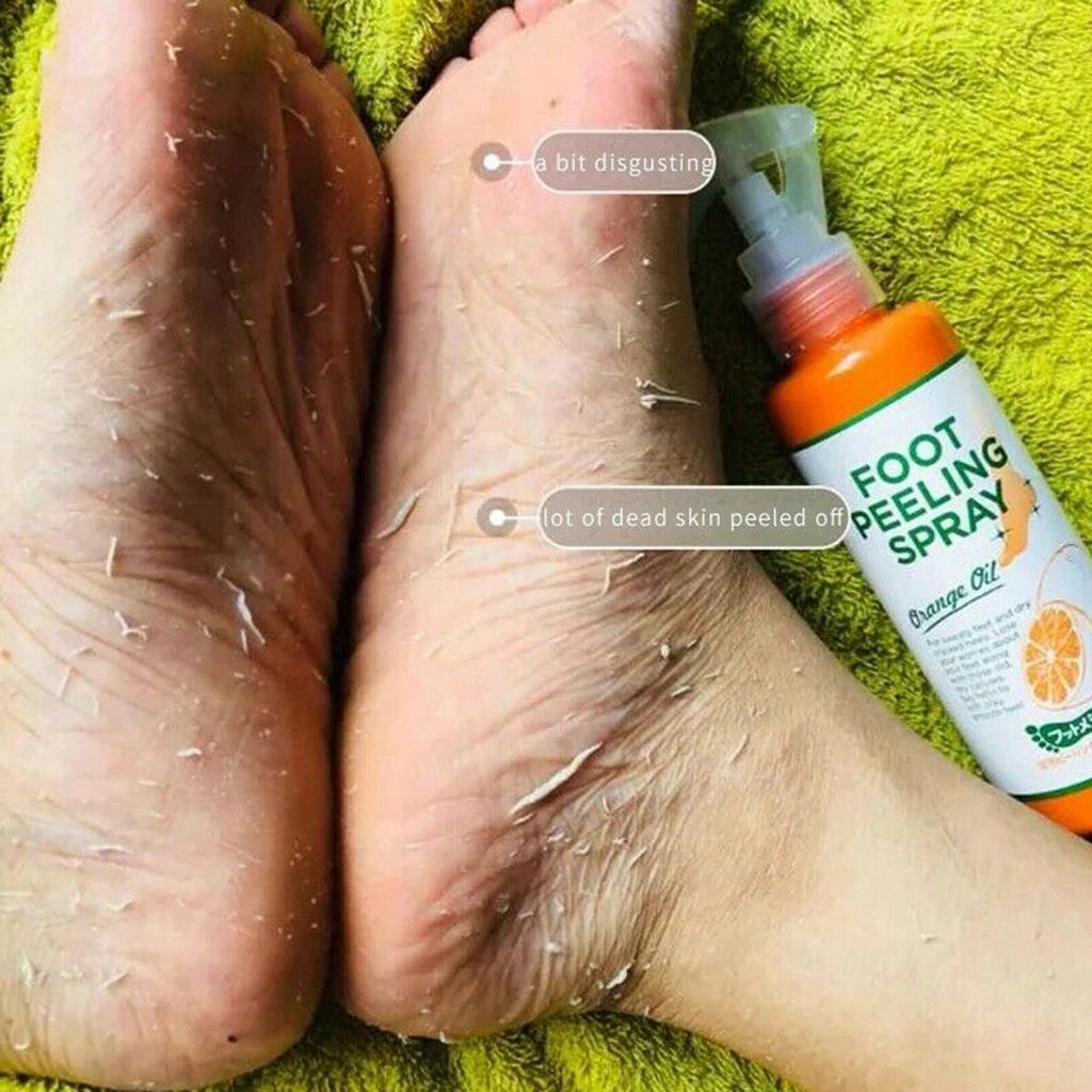 100ML Foot Peeling Spray Nourish Moisturizing Elbow Exfoliating Essence Dead Skin Remover Pedicure Foot Care Tool