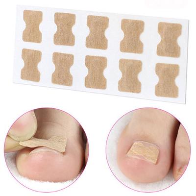 Glue-Free Nail Stickers Toenail Groove Ingrown Nail Correction