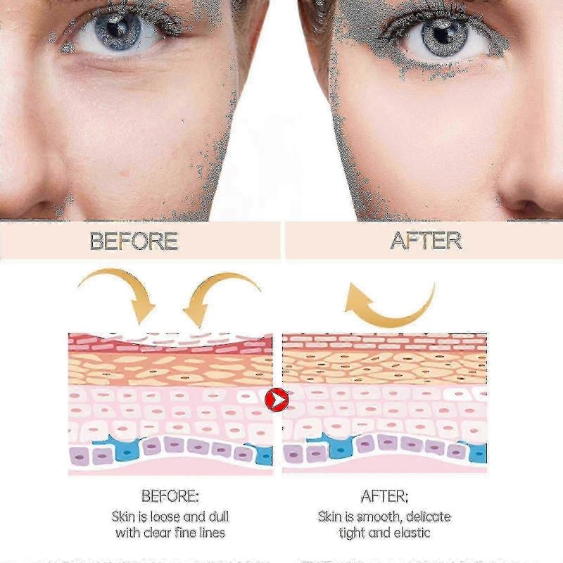 3PCS Ouhoe Antiwrinkle Moisturizing Cream Stick Anti-wrinkle Hydrating Skin Fades Fine Lines On Face And Neck Lines Brightens Skin Anti-aging