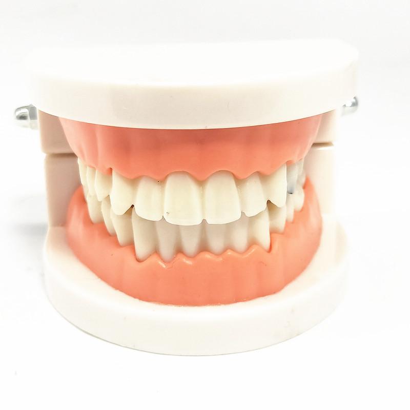 1 Piece Dental Tooth Model Standard Teeth Model Dental Caries Model for Patient Communication Dentist Study Model with Decayed Tooth