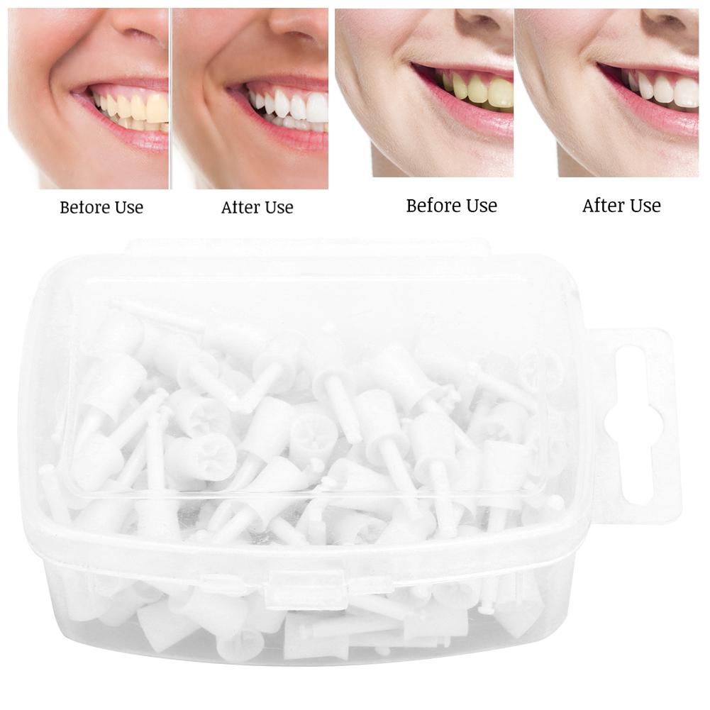100pcsbox Disposable Dental Polishing Cup Dental Materials Dental Accessory