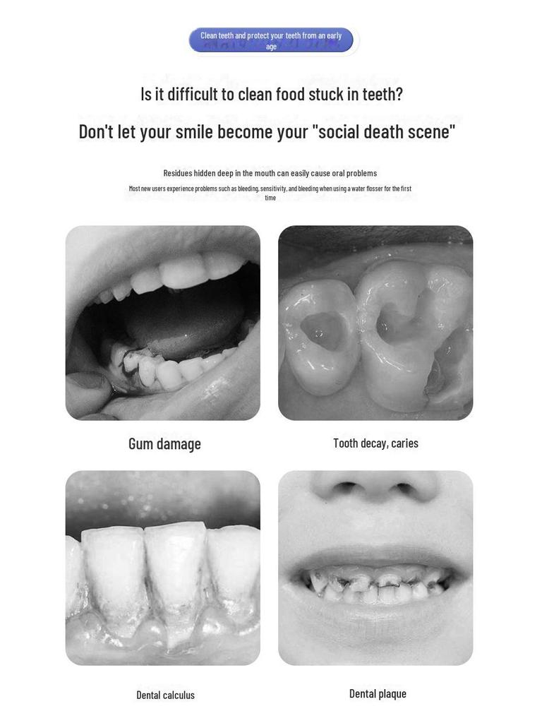 Portable Electric Ultrasonic Water Flosser with Telescopic Tank - Waterproof Oral Cleaner and Tartar Remover