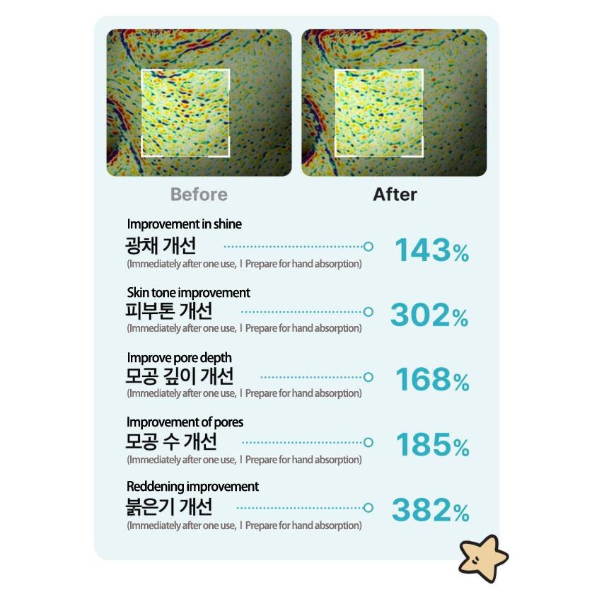 Medicube AGE-R Booster Pro Mini Plus Beauty Device(Beige)