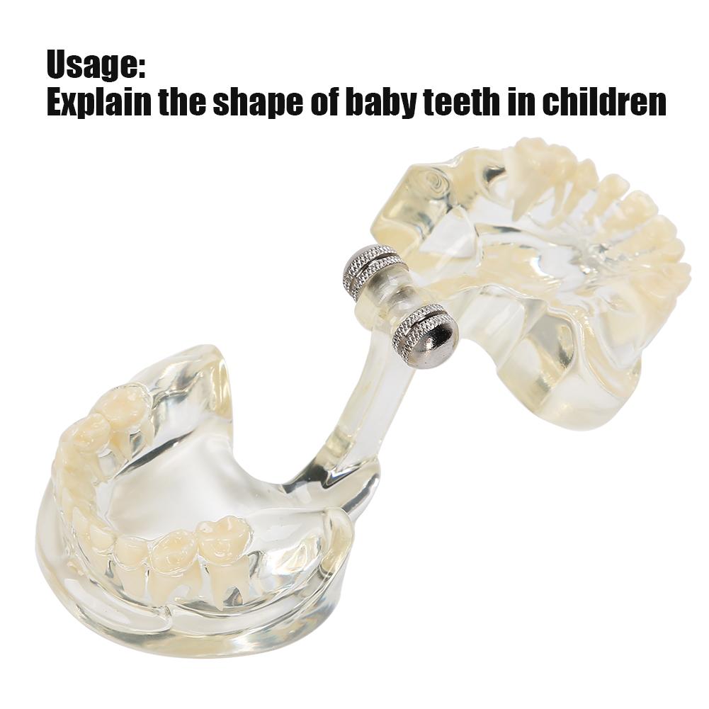 Dental Deciduous Teeth Model Removable Teeth Model Teaching Tool for Dentist