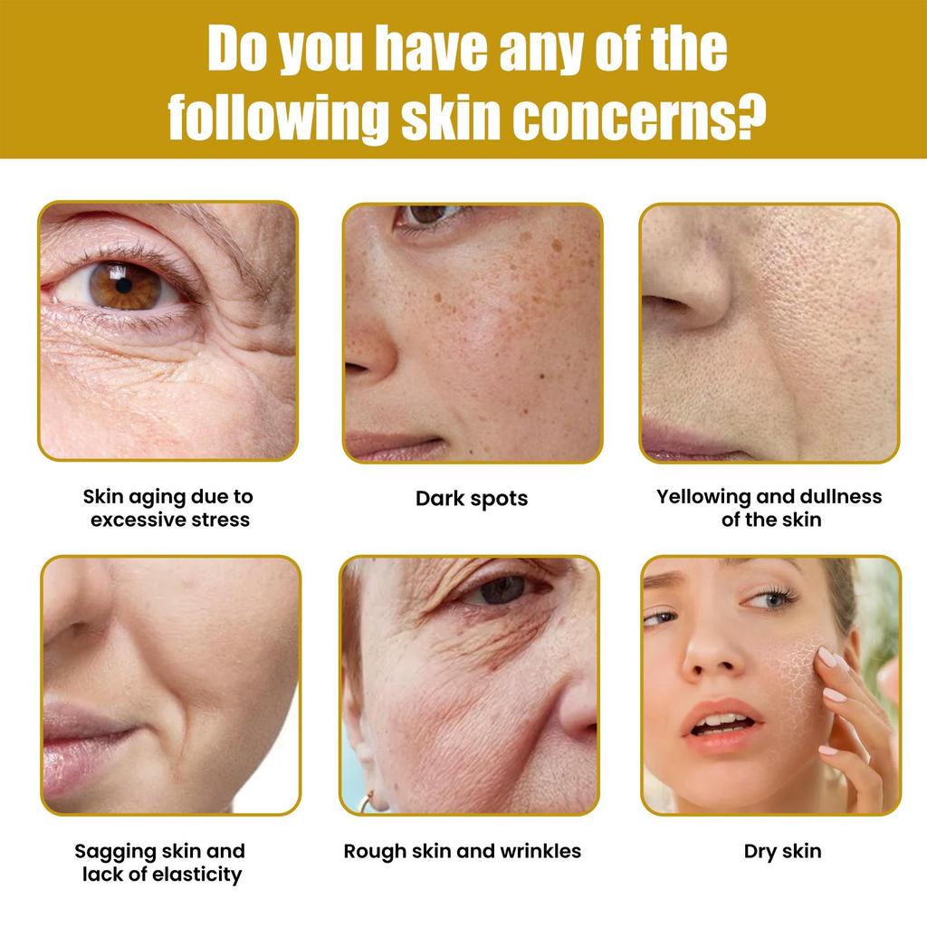 Multi-Benefit Bee Venom Cream - Anti-Aging, Fades Wrinkles/Nasolabial Folds, Hydrating & Brightening